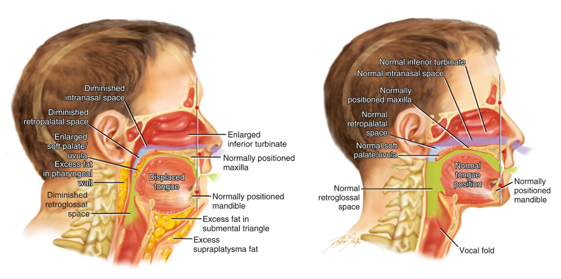 Airway Anatomy